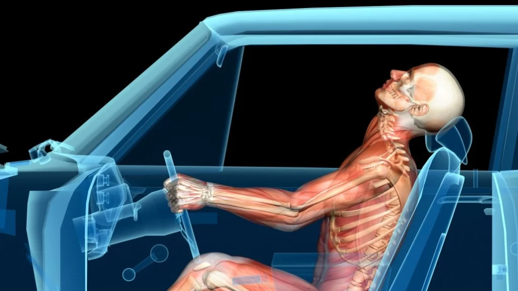 whiplash treatment Aurora CO